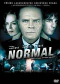 normal.jpg normal.jpg
